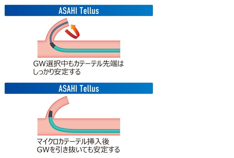 ASAHI Tellus/C3 | Interventional Radiology製品情報 | ASAHI