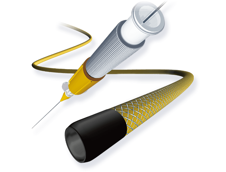 Masters PARKWAY HF | Medical products for Interventional Radiology